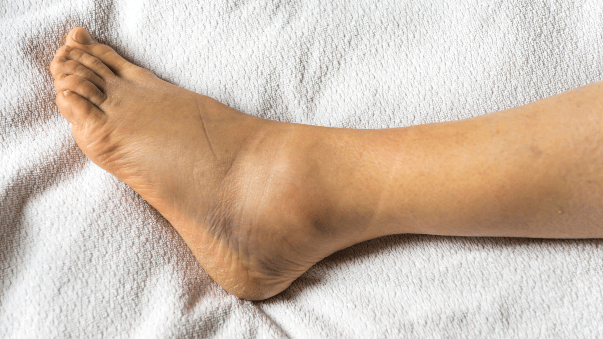 reduce swelling ankle